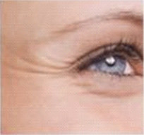 Lachfalten - Dr. Salloum in Leipzig