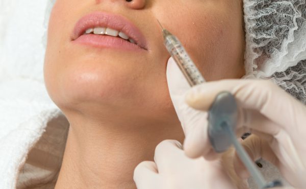 Nasolabilafaltenunterspritzung in Leipzig